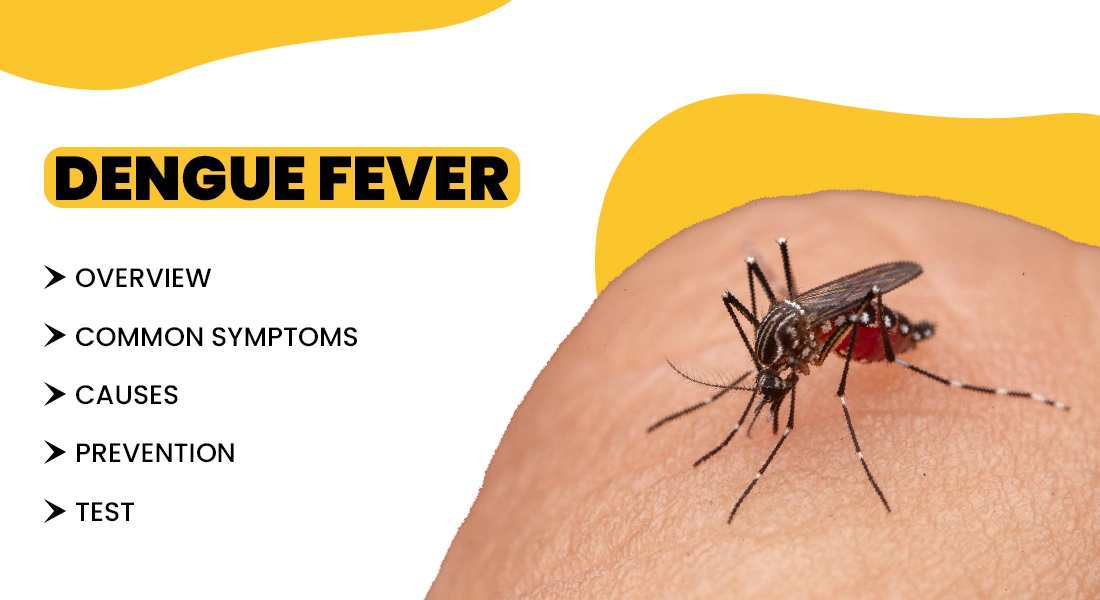 How To Treat dengue Fever? what is its symptoms and casues