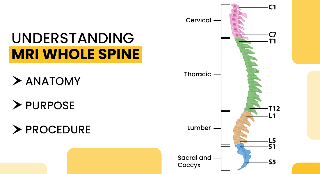What is MRI of Whole Spine? Anatomy, Cost, and Purpose